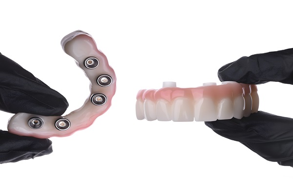 Why Choose Implant Supported Dentures?