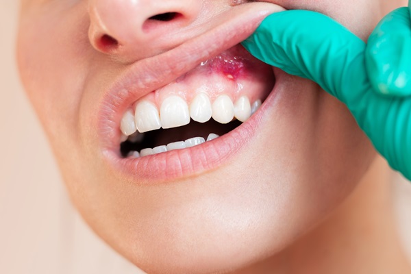 The Importance Of Periodontal Gum Disease Treatment